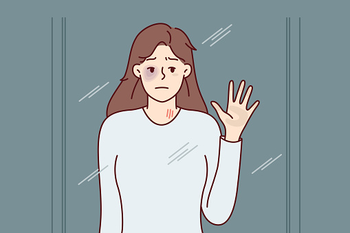 Unhappy woman with black eye looks in mirror or out window. Girl suffers after getting bruise from domestic violence and needs help and support of friends or psychotherapist. Flat vector image
