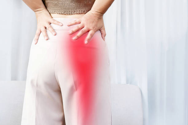 koncepcja bólu rwy kulszowej z kobietą cierpiącą na ból pośladków rozprzestrzeniający się na dolną nogę - bad ass zdjęcia i obrazy z banku zdjęć