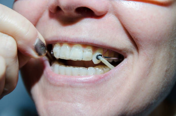 Teenage girl showing off her braces