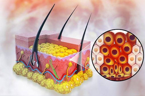 Spreading of cancer cell in human skin layer, Skin cancer, Medical diagram. 3d illustration