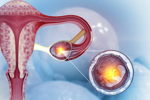 eileiterschwangerschaft. befruchtetes ei heftet sich irgendwo außerhalb der gebärmutter. 3d-illustration - eileiterschwangerschaft stock-fotos und bilder