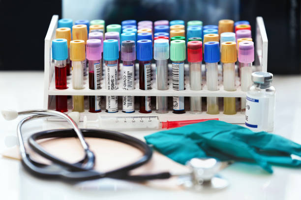 진료소 실험실에 있는 작업대에 있는 혈액 시험 관을 가진 쟁반 - laboratory workbench rack indoors 뉴스 사진 이미지