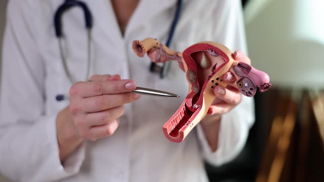 Gynecologist shows structure of uterus on model of uterus