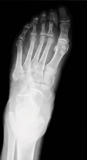 radiografia del piede - mri scan cat scan machine x ray brain foto e immagini stock