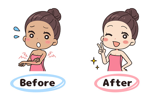 Illustration of a woman before and after sunburn.
