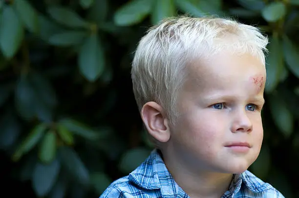 This boy was trying to bike for the first time, and ended up with his head on the streets... If he had only used his helmet!