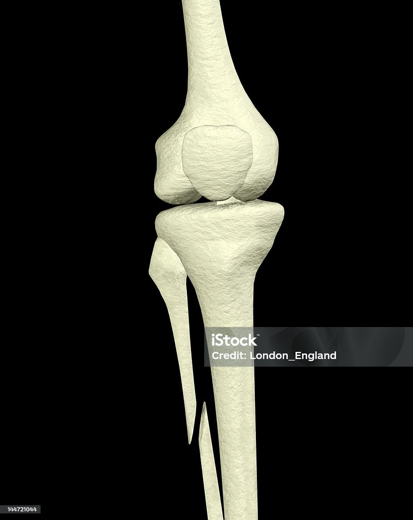 Jambe cassée - Photo de Anatomie libre de droits