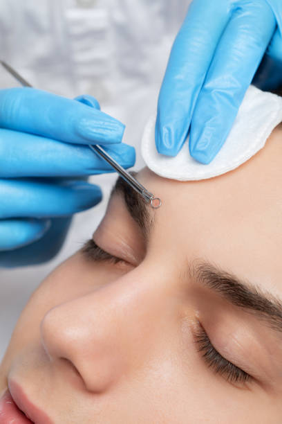 istock A young guy with problem skin on his face. Photos before and after acne treatment. 1447247698
