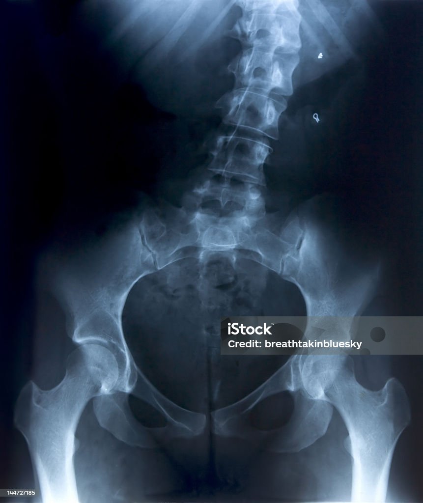 X-Ray di femmina pelvi e parte inferiore della schiena - Foto stock royalty-free di Piegato - Descrizione generale