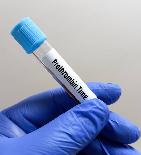 istock Blood Sample for Prothrombin Time (PT) test. Blood coagulation testing. Medical or health concept. P Time. White background. 1447613807