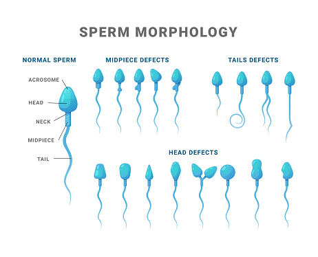 Sperm morphology count type educational medical scheme vector flat illustration. Biology fertility diagram science medicine diagram structure normal midpiece tail head defect example explanation