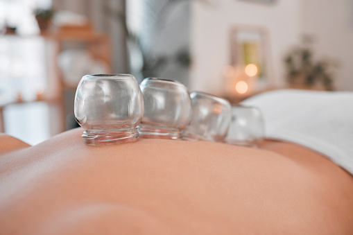 Cupping, therapy and wellness for body in spa, health and healing with alternative medicine. Body care, stress relief and balance, holistic and massage therapy, vacuum banks and healthy treatment.