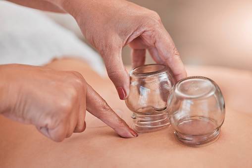 Cupping, therapy and back massage at a wellness, health and beauty spa at a self care resort. Healing, body care and hands of a therapist doing healthy treatment with vacuum glasses for stress relief