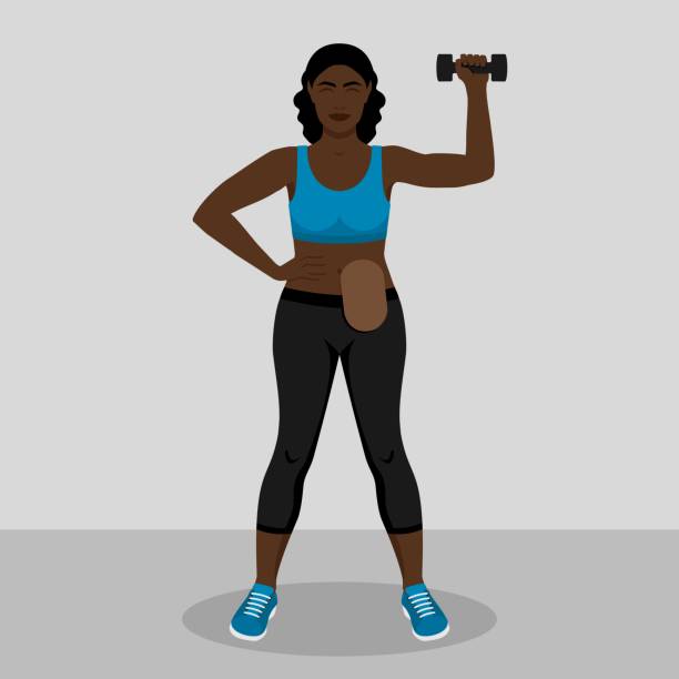 Young black woman with colostomy bag is engaged in fitness with dumbbell Young black woman with colostomy bag is engaged in fitness with dumbbell. Vector illustration stomata stock illustrations