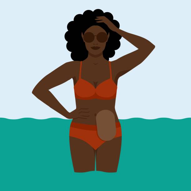 Black woman with colostomy bag on sea holiday Black woman with colostomy bag on sea holiday. Vector illustration stomata stock illustrations