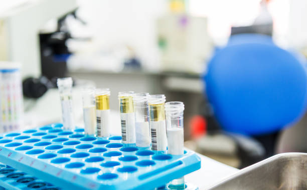istock Rack of tubes and laboratory microscope 1448272653