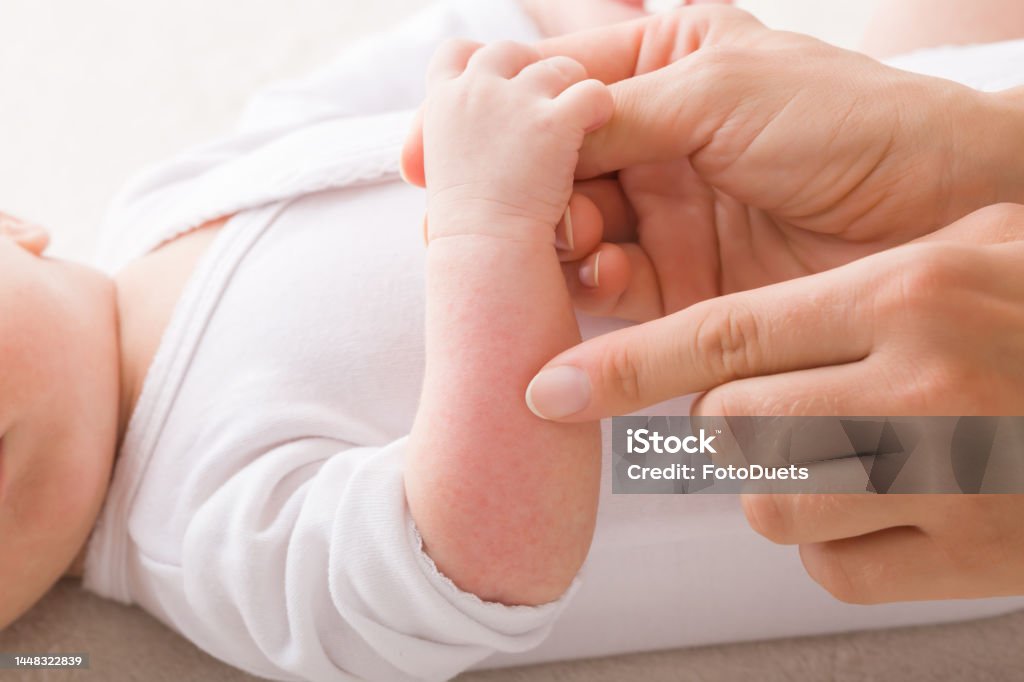 Young adult mother finger pointing to newborn arm with red rash. Allergy from milk formula or mother milk. Baby skin problem. Closeup. Side view. Baby - Human Age Stock Photo