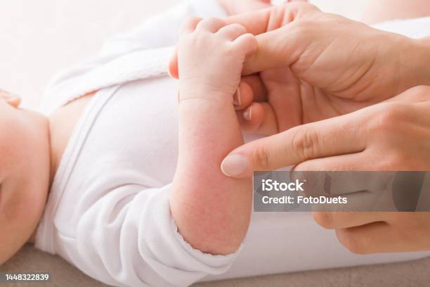 Young Adult Mother Finger Pointing To Newborn Arm With Red Rash Allergy From Milk Formula Or Mother Milk Baby Skin Problem Closeup Side View Stock Photo - Download Image Now
