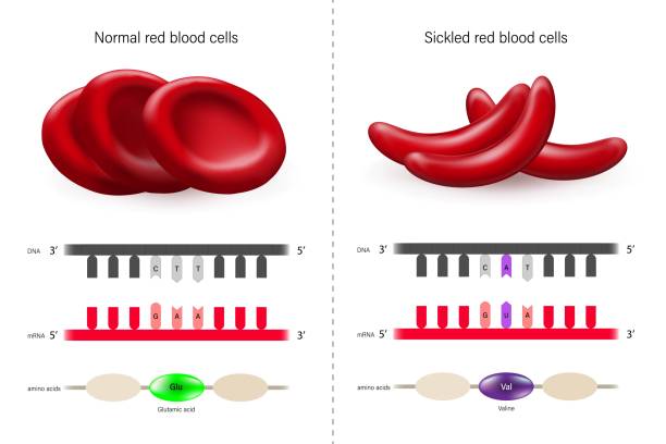 ilustraciones, imágenes clip art, dibujos animados e iconos de stock de enfermedad de células falciformes. glóbulos rojos normales y glóbulos rojos falciformes. mutación puntual. - sickle cell anemia red blood cell blood cell anemia