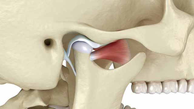 Temporomandibular joints and dislocated articular disc. Medically accurate 3D animation