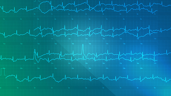 heart rhythm control chart blue background
