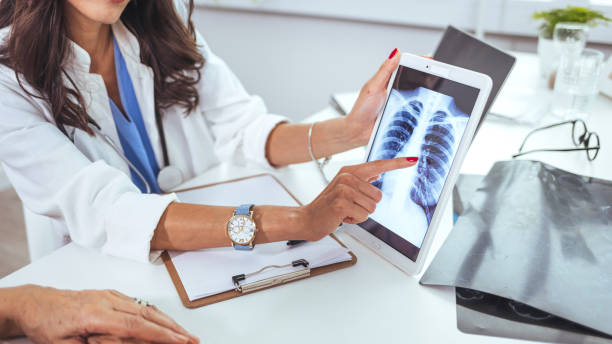 doctor explaining results of lung check up from x-ray scan chest on digital tablet - x ray image radiologist examining using voice imagens e fotografias de stock