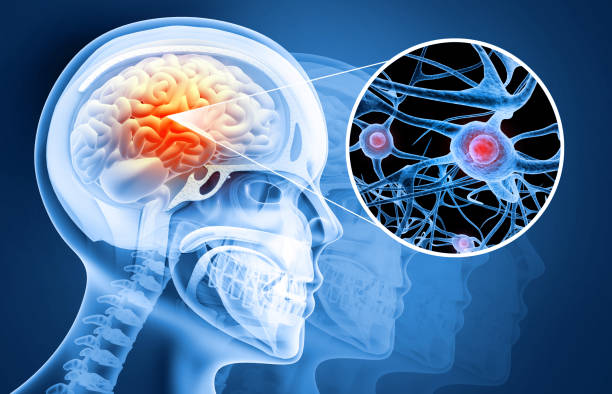 istock Human brain damage and treatment concept. 3d illustration 1448517508