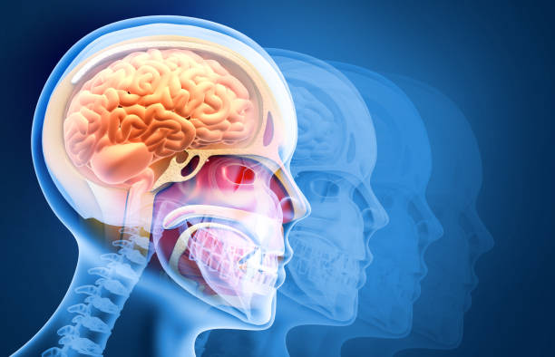 ilustración médicamente precisa de un cerebro doloroso, hombre con dolor de cabeza, estoque, coágulo de sangre en los vasos del cerebro humano, ilustración 3d - stike fotografías e imágenes de stock