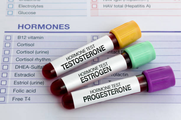 Blood test tubes for Testosterone, Estrogen and Progesterone analysis hormonal samples of Blood for sexual hormones Analysis Testosterone, Estrogen and Progesterone in men and women. Blood test tubes for Testosterone, Estrogen and Progesterone analysis hormonal fertiity blod test stock pictures, royalty-free photos & images