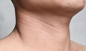 Aging skin folds or skin creases or wrinkles at neck of Asian old man. Concept of sore throat, pharyngitis or laryngitis.