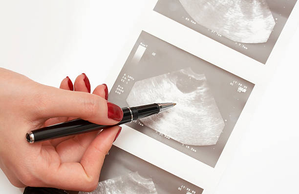 A doctor explains the ultrasound results to a patient stock photo