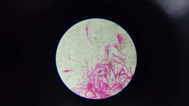 istock Microscopic view of penicillium notatum fungus. 1449133043