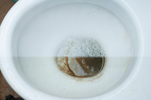 Photos before and after cleaning a dirty toilet, the result of using different detergents from large pollution