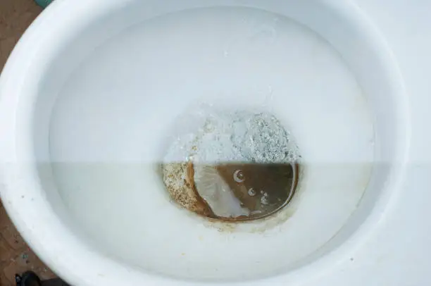 Photo of Photos before and after cleaning a dirty toilet, the result of using different detergents from large pollution