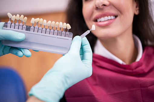 Dentist matching the right white tone for a dental crown using a color swatch palette.