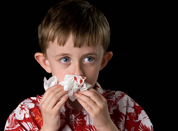 Bloody nose stock photo