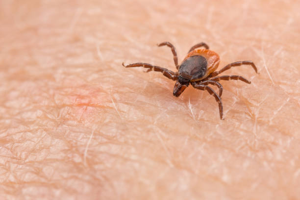 Carrapato parasita perigoso da mamona pica a pele humana. Ixodes ricinus ou scapularis - Close-up de ácaro inseto na epiderme rosa. Perigo de transmissão de doenças transmitidas por carrapatos por carrapatos parasitas infectados - fotos e imagens de stock, livres de direitos