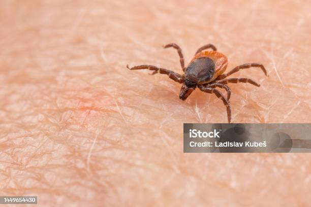 Dangerous Parasitic Castor Bean Tick At Biting To A Human Skin Ixodes Ricinus Or Scapularis Stock Photo - Download Image Now
