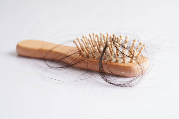 istock Hair loss fall with comb brush isolated on white background. 1449702554