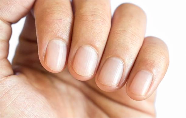 pequeñas lúnulas o medias lunas en las uñas con líneas longitudinales del sudeste asiático, joven. aislado sobre blanco. - human finger fotografías e imágenes de stock