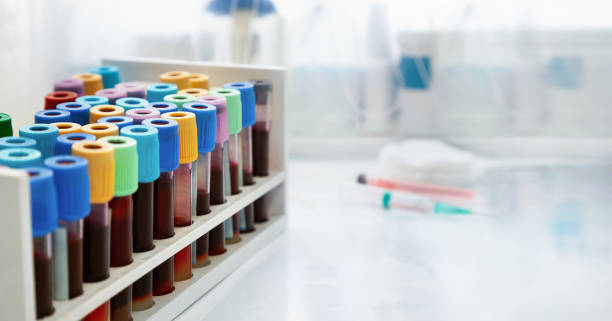 Workplace Rack with tubes of blood samples from patients in the Clinical Analysis laboratory of the hospital stock photo