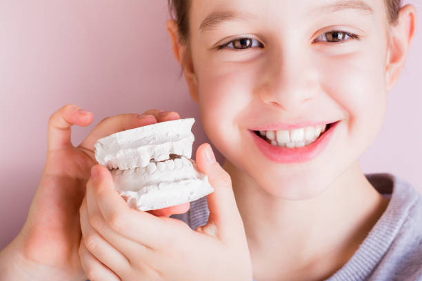 ein mädchen mit schiefen zähnen hält einen gipsverband ihrer zähne. zahnmedizin und kieferorthopädie - fehlbiss stock-fotos und bilder