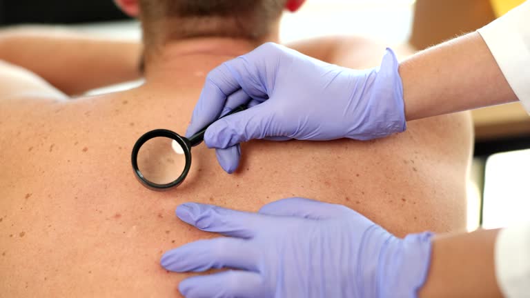 Dermatologist examines back birthmark and birthmark of patient with magnifying glass in clinic