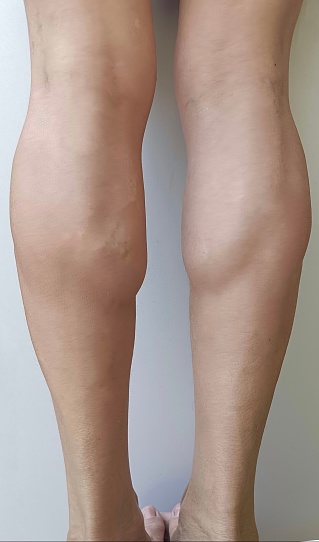 Woman have muscles in their calves.