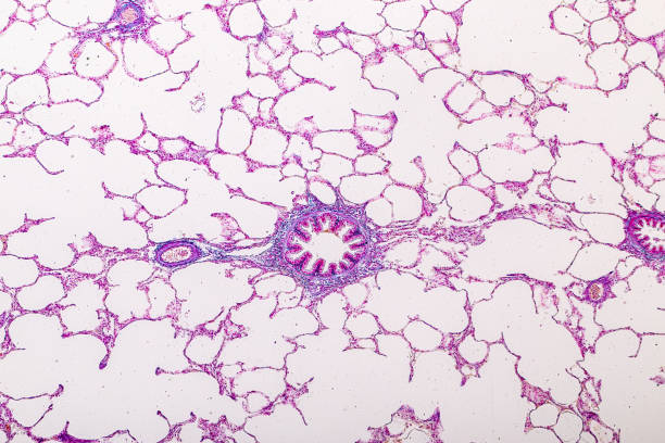 istock Lung and Pituitary gland Human under the microscope. 1450531863