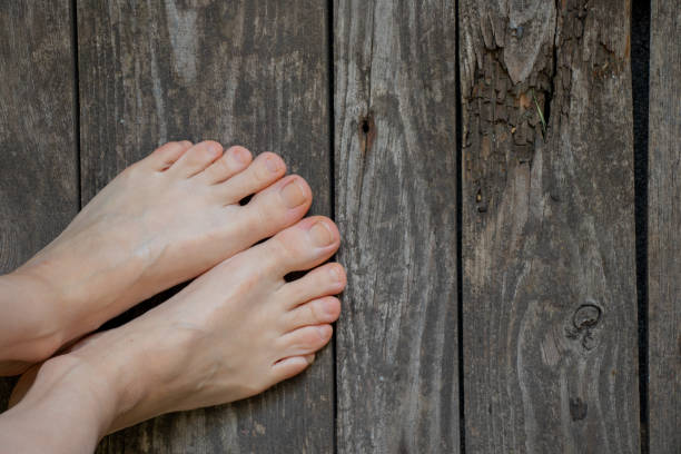 istock female bare legs young legs on an isolated background close-up 1450565740