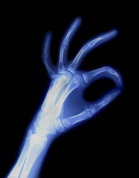 Hand X-ray stock photo