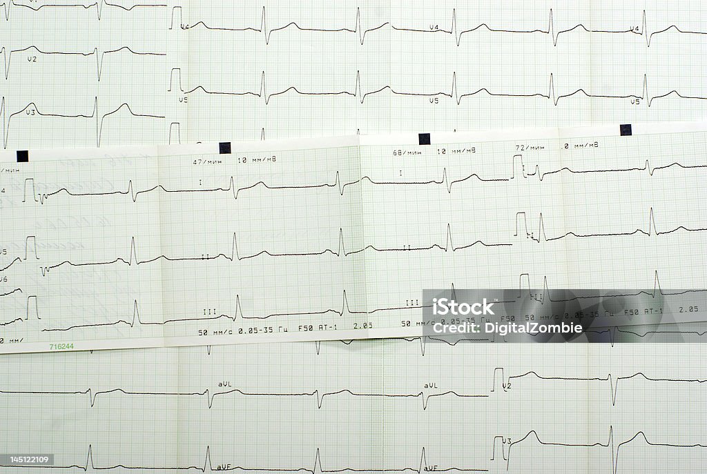 cardiogram sfondo - Foto stock royalty-free di Analizzare