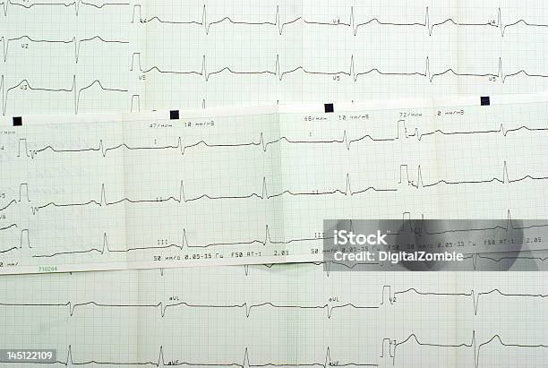 Cardiogram Sfondo - Fotografie stock e altre immagini di Analizzare - Analizzare, Attrezzatura, Close-up