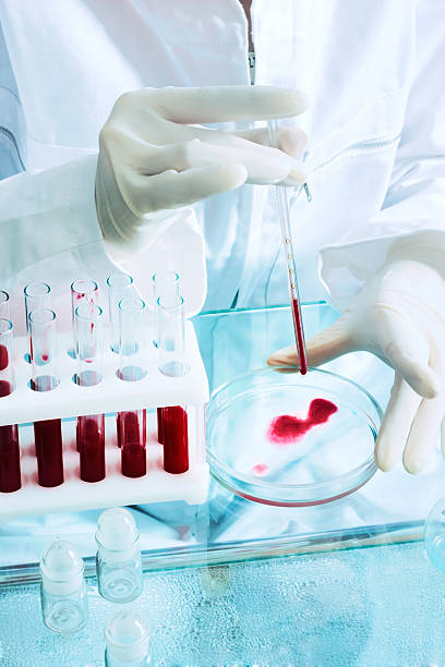 istock A medical technologist placing blood on a petri dish 145132488